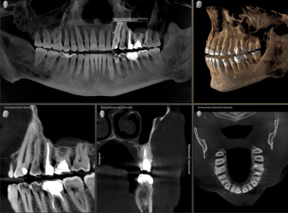 kt-zubov-700x518